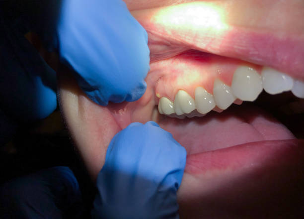 Best Teeth Whitening  in Imlay City, MI