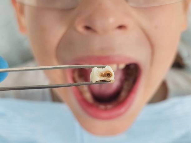 Best Tooth Infection Emergency Dentist  in Imlay City, MI