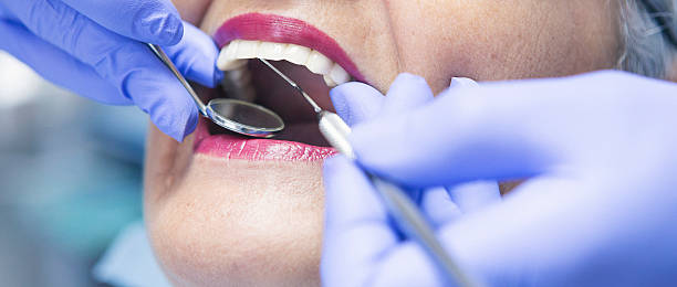 Best Root Canal Emergency Dentist  in Imlay City, MI